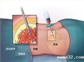 穿刺针冲压厂家